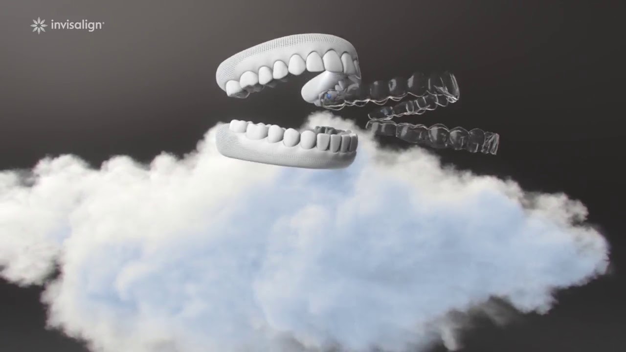 invisalign London Video